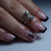 Kép 4/10 - Roniki poly gel - 17 - 30g